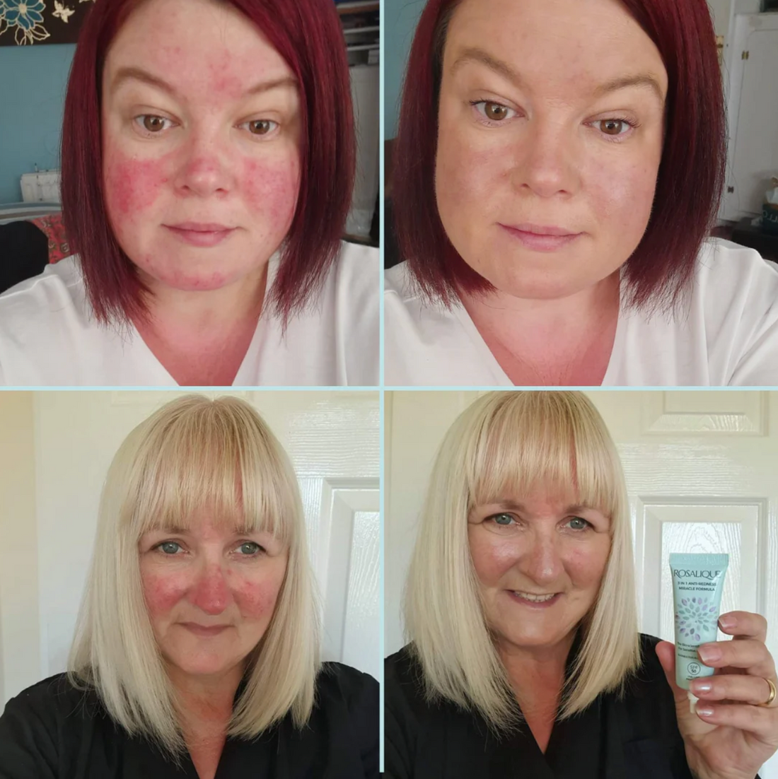 Rosalique 3 in 1 Anti-Redness Miracle Formula SPF50
